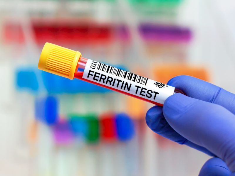 Ferritin Eksikliği Nedir, Belirtileri Nelerdir?