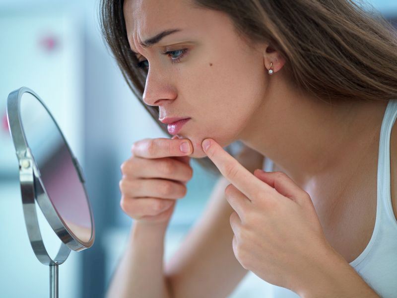 Neden Sivilcelere Diş Macunu Sürmemeliyiz?